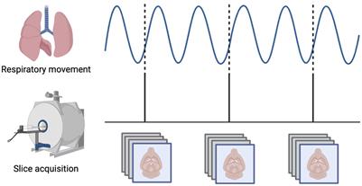 Variation in the distribution of large-scale spatiotemporal patterns of activity across brain states